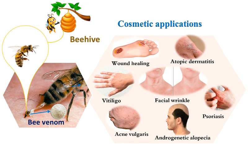 Bee Venom Therapy