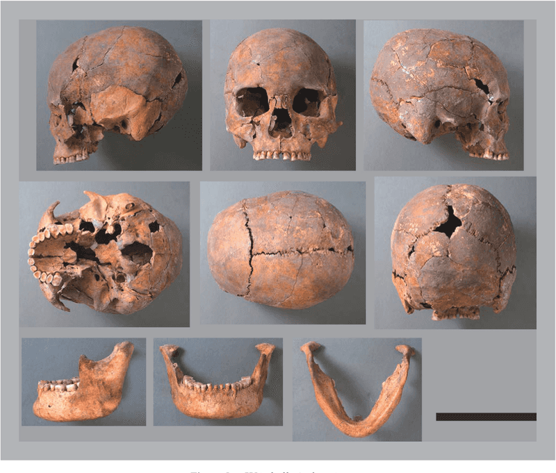 Jomon Period Skulls