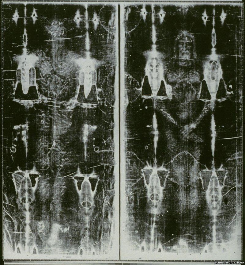 The Shroud of Turin