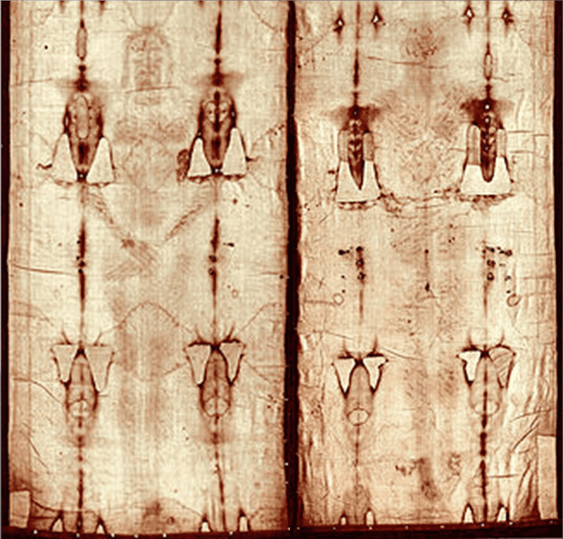 The Shroud of Turin