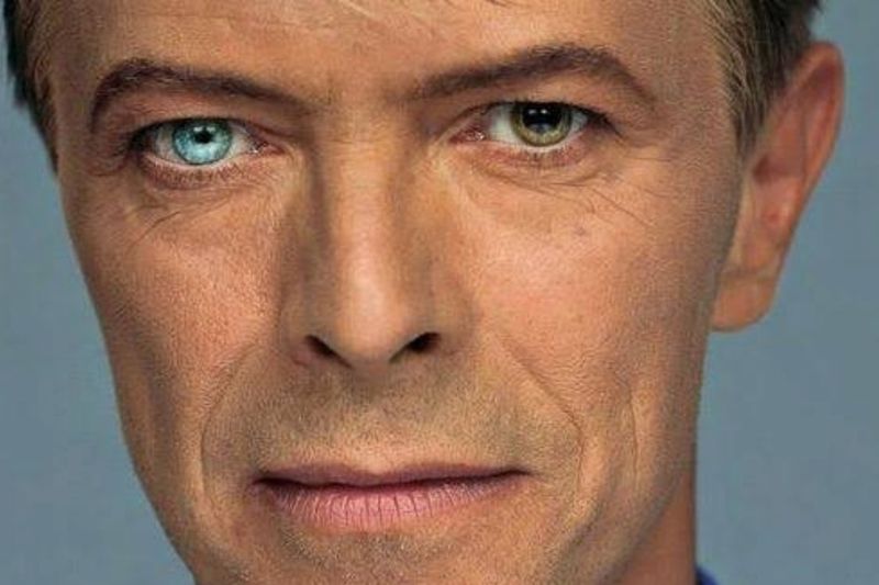 David Bowie’s Unique Eyes