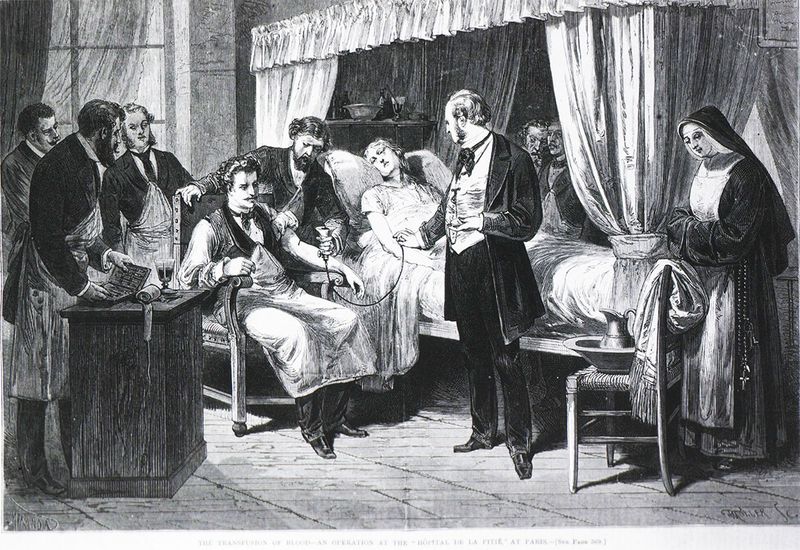 Development of Blood Transfusion Techniques (Mid-1800s)