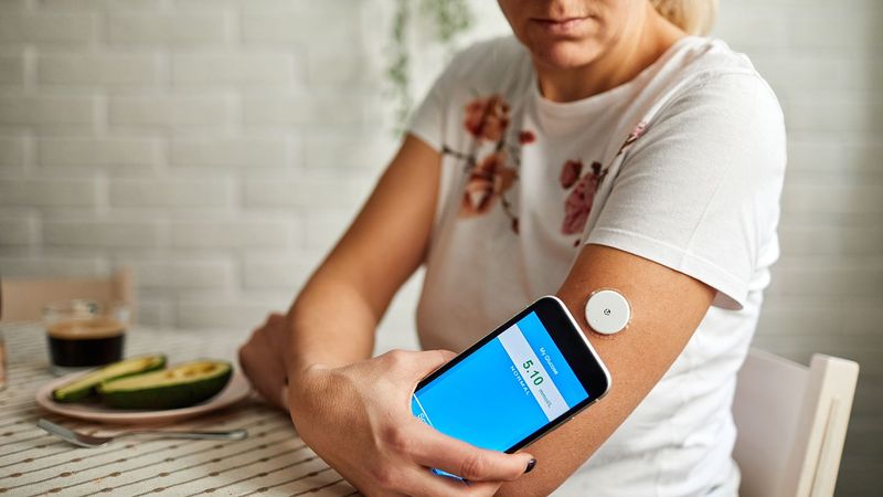 Innovations in Diabetes Management (Insulin Pumps & Continuous Glucose Monitoring – 21st Century)