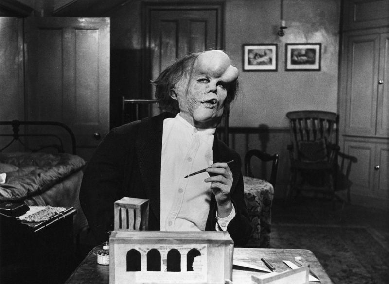 Joseph Merrick (“The Elephant Man”)