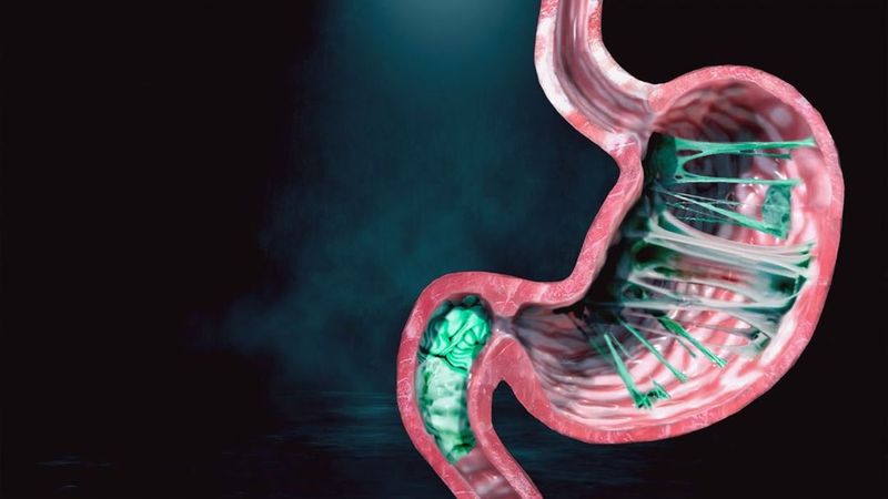 Swallowed Gum Stays in Your Stomach for Seven Years
