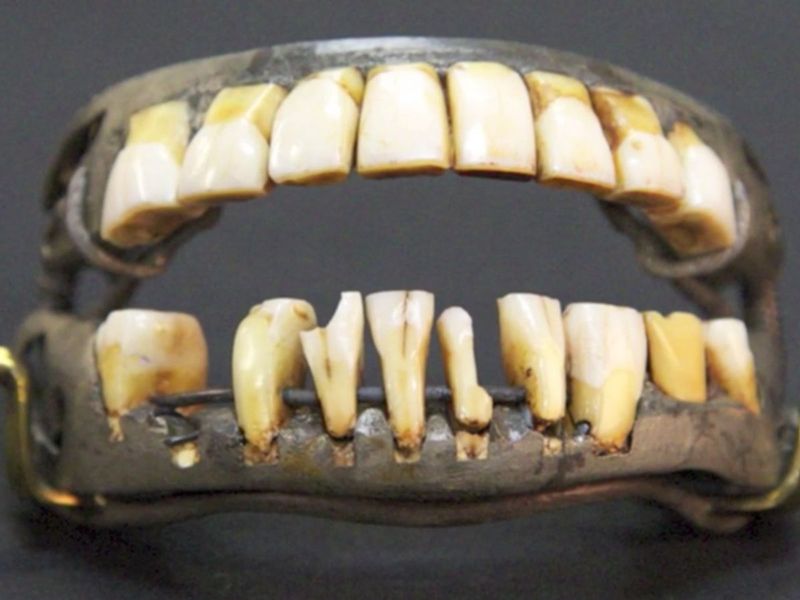 George Washington’s “Wooden Teeth”