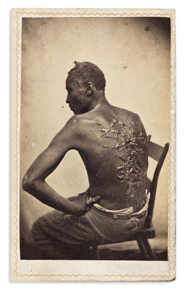 Whip-Scar Photograph