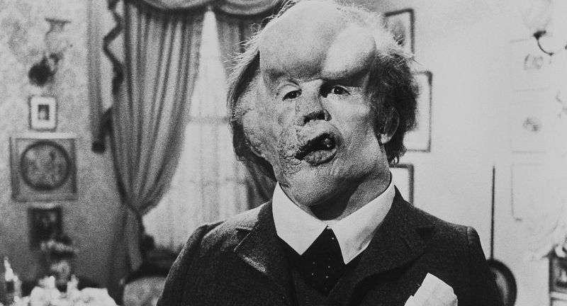 Joseph Merrick: The Elephant Man's Dignity