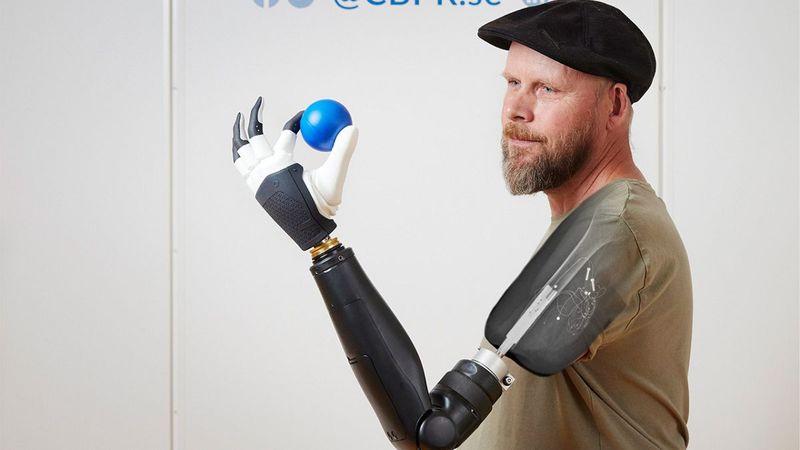 Artificial Limbs
