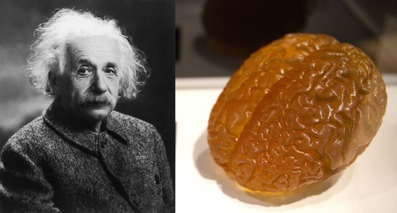Albert Einstein’s Brain (1955)