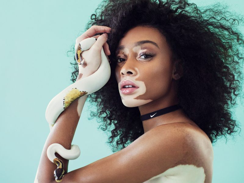 Winnie Harlow