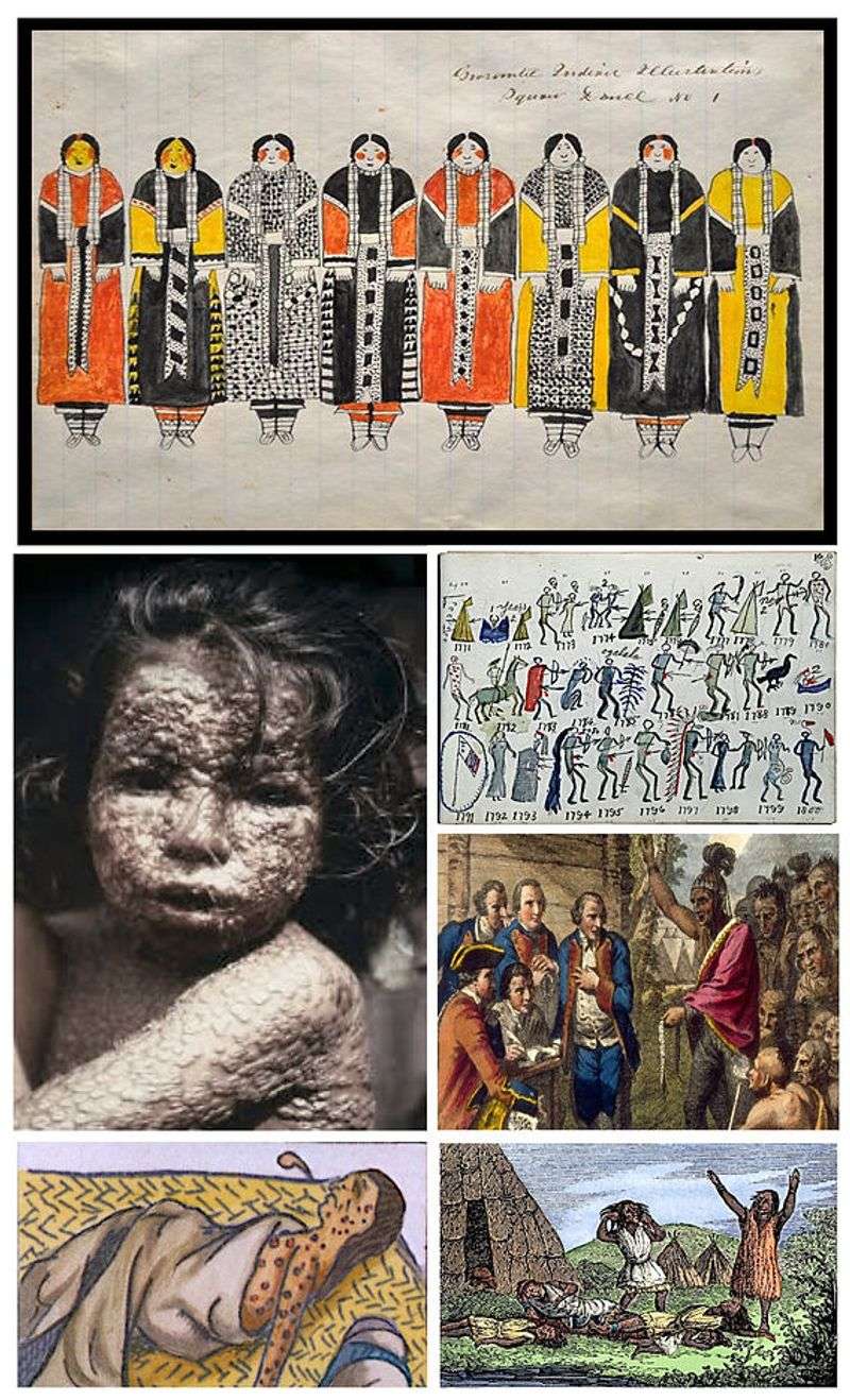 Smallpox – A Scourge on Settlers and Natives Alike