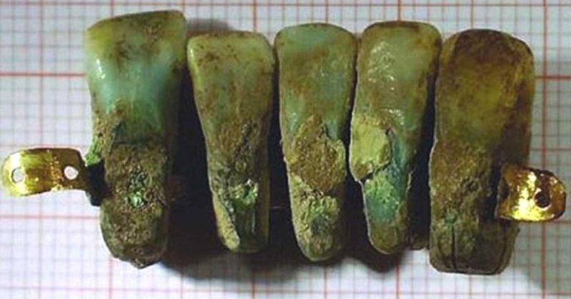 Wooden Dentures 😬 → Dental Implants