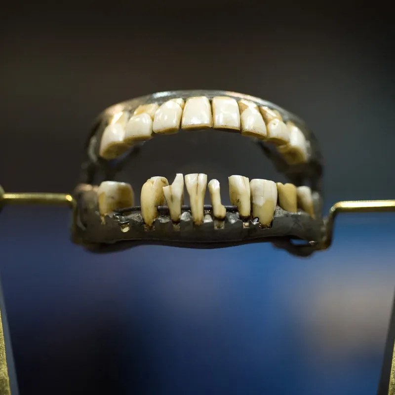 George Washington’s Dentures (1780s)