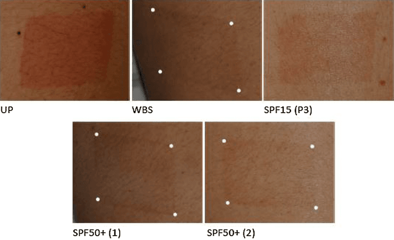 The Science Behind SPF Testing (Present Day)