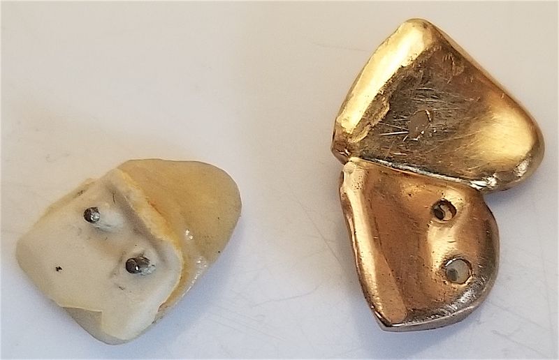 Nazi Teeth (Seriously)