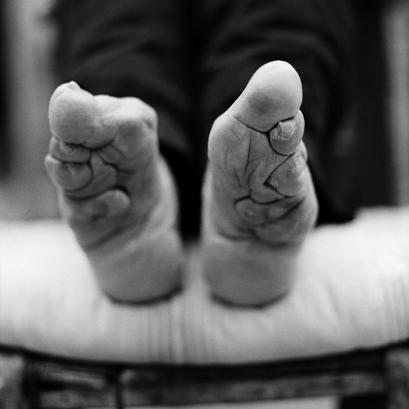 Foot Binding (Ancient China)