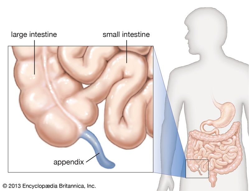 The Human Appendix Has a Purpose (Long Dismissed as Useless)
