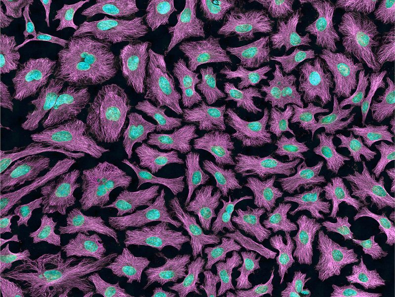 The Cells That Wouldn't Die