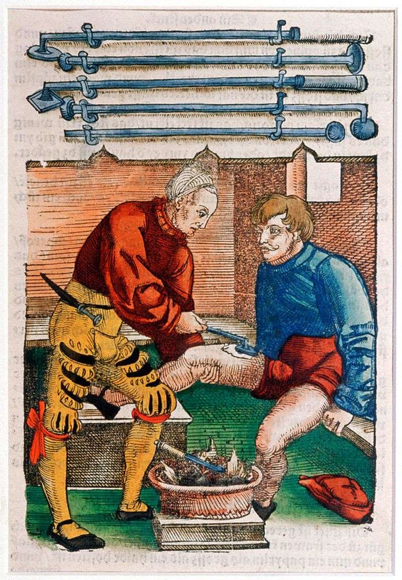 Cauterization (Burning Wounds Shut)