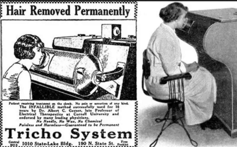 X-Ray Hair Removal (1920s)