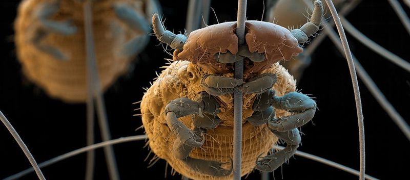 Lice and Flea Infestations Were Common