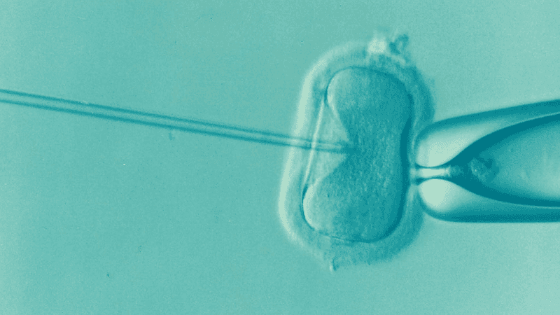 IVF (Test-Tube Babies)