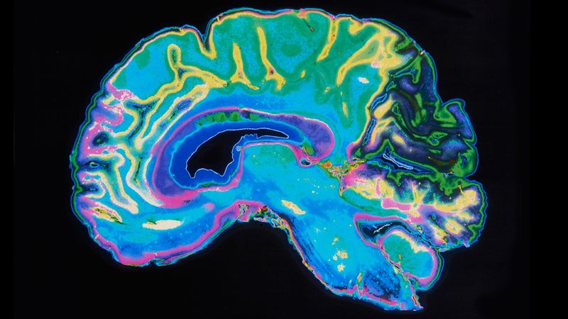 Brains Don't Come in Male and Female Models