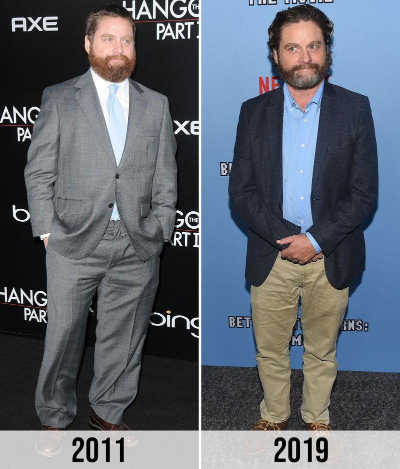 Zach Galifianakis – Slimmed Down and Silent About It
