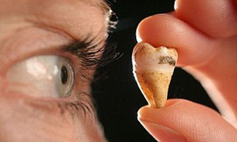 John Lennon’s Molar Tooth ($31,000)