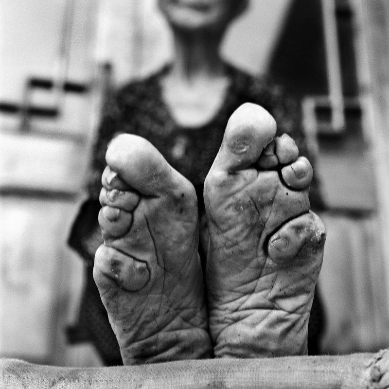 Foot Binding (China, 10th–20th Century)