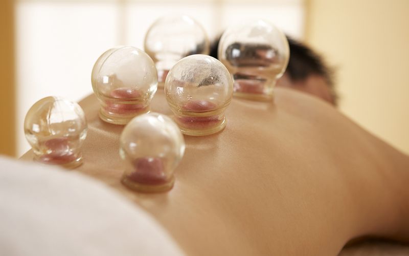 Cupping