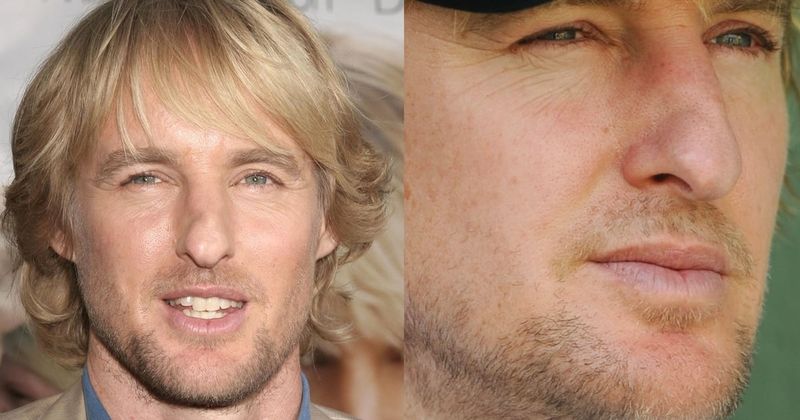 Owen Wilson's Famously Broken Nose