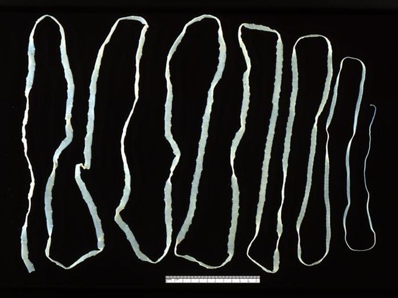 Tapeworm Diet Pills (Early 1900s)