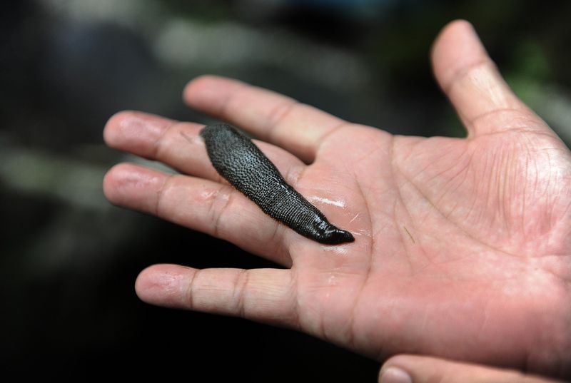 Leech Therapy