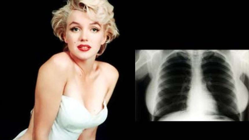 Marilyn Monroe’s X-Ray ($45,000)