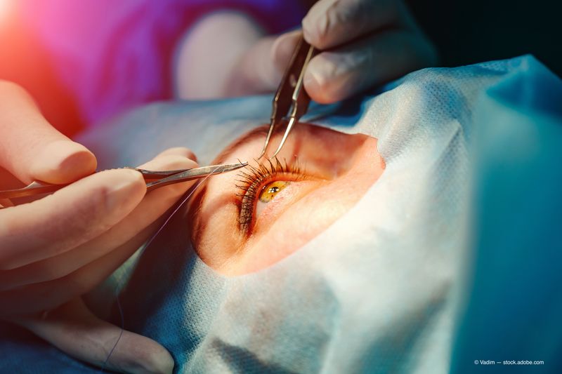 Laser Cataract Surgery Restores Vision