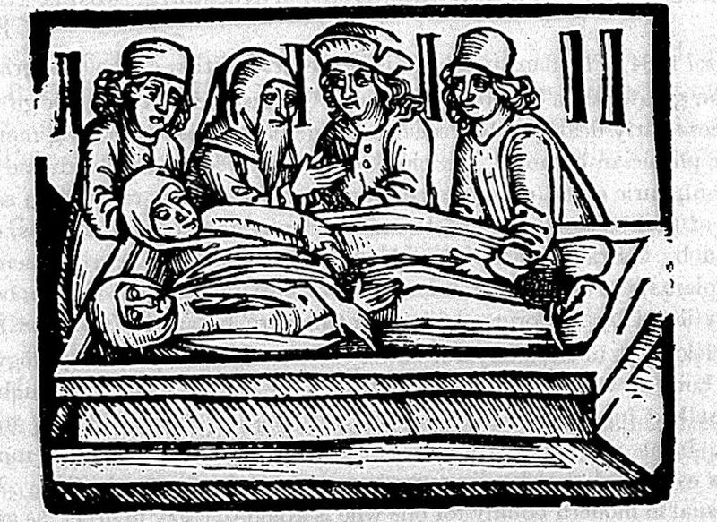 The Sweating Sickness (1485–1551, England)